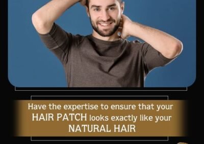 Anassheikh Parmanent hair patch Solution-3