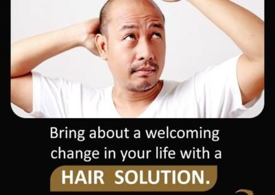 Anassheikh Parmanent hair patch Solution